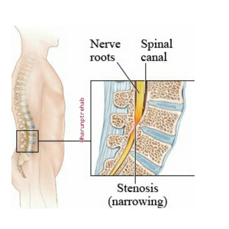 19621190_1777038342587703_6006865744893711371_o